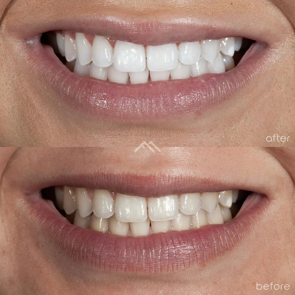 Foothill Modern Dental - Selina Sarno, DDS Picture 5