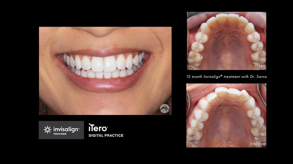 Foothill Modern Dental - Selina Sarno, DDS Picture 8