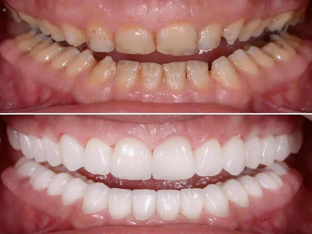 Smile on You Dentistry of Lake Forest Picture 3