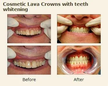 Excel Dental, Orthodontics & Implant Center Picture 3