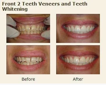 Excel Dental, Orthodontics & Implant Center Picture 5