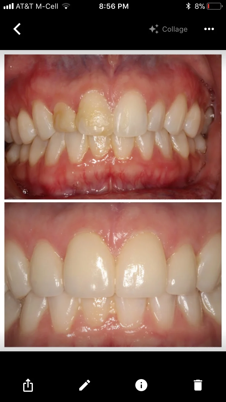 Laguna Niguel Cosmetic Dentist, HealthySmile360, Dr.Mostofi Picture 10