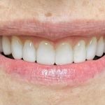 Richard O'Braitis DDS