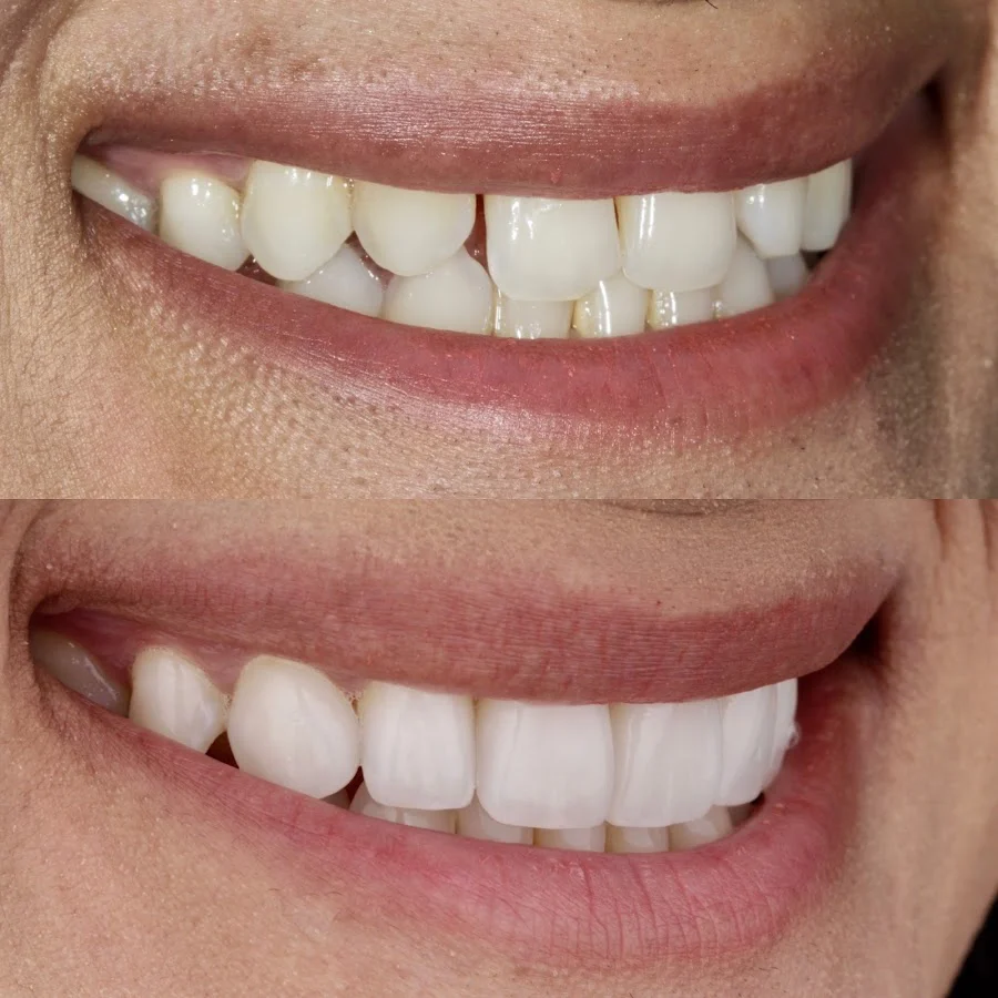 Nova Cosmetic Dentistry (general and cosmetic) Picture 5