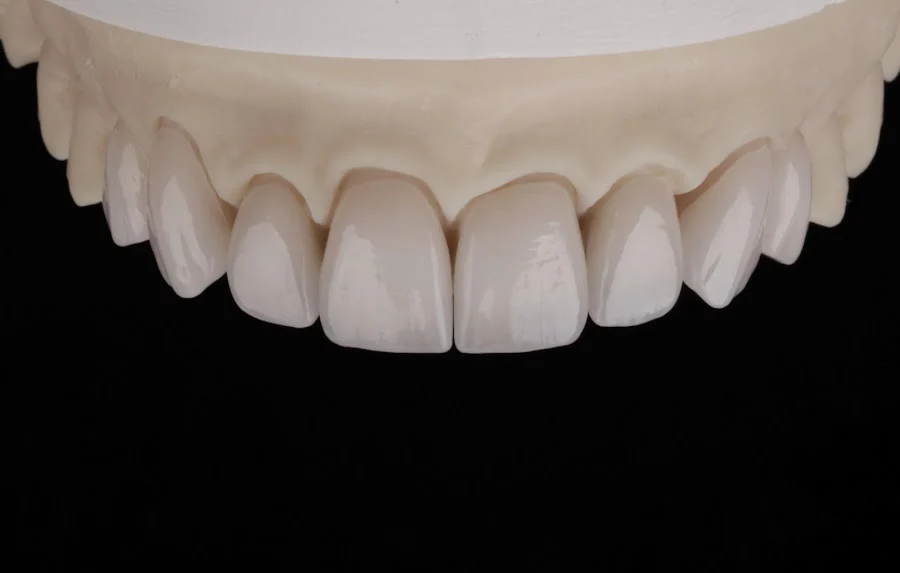 Nova Cosmetic Dentistry (general and cosmetic) Picture 2