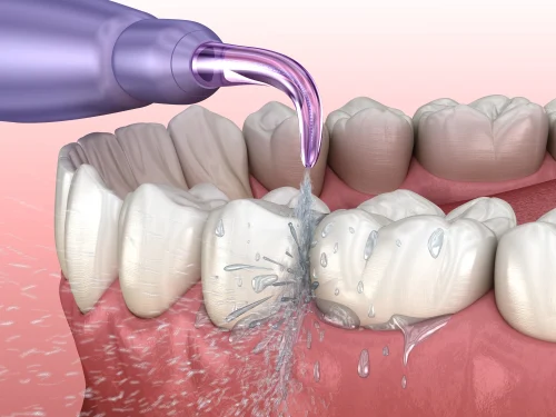 Lakeland Dental Picture 9