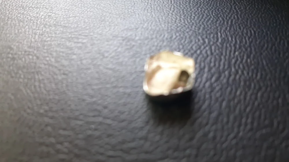 Indian Hills Dental Picture 10