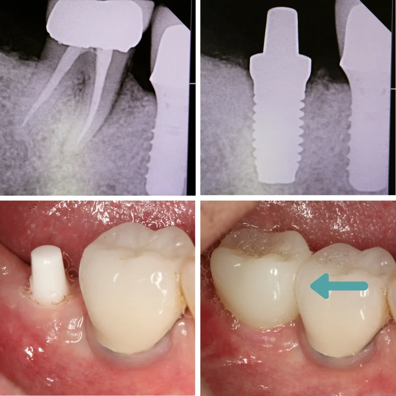 Mission Implant Center Picture 6