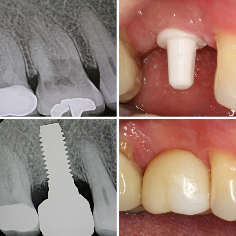 Mission Implant Center Picture 3