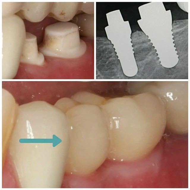 Mission Implant Center Picture 8