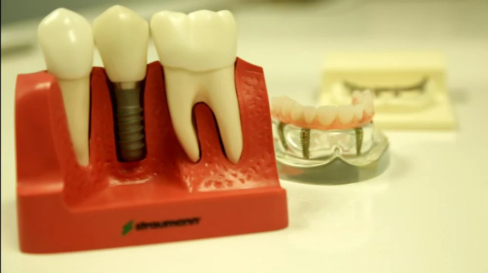 Pacific Oral Surgery & Dental Implant Studio Picture 9