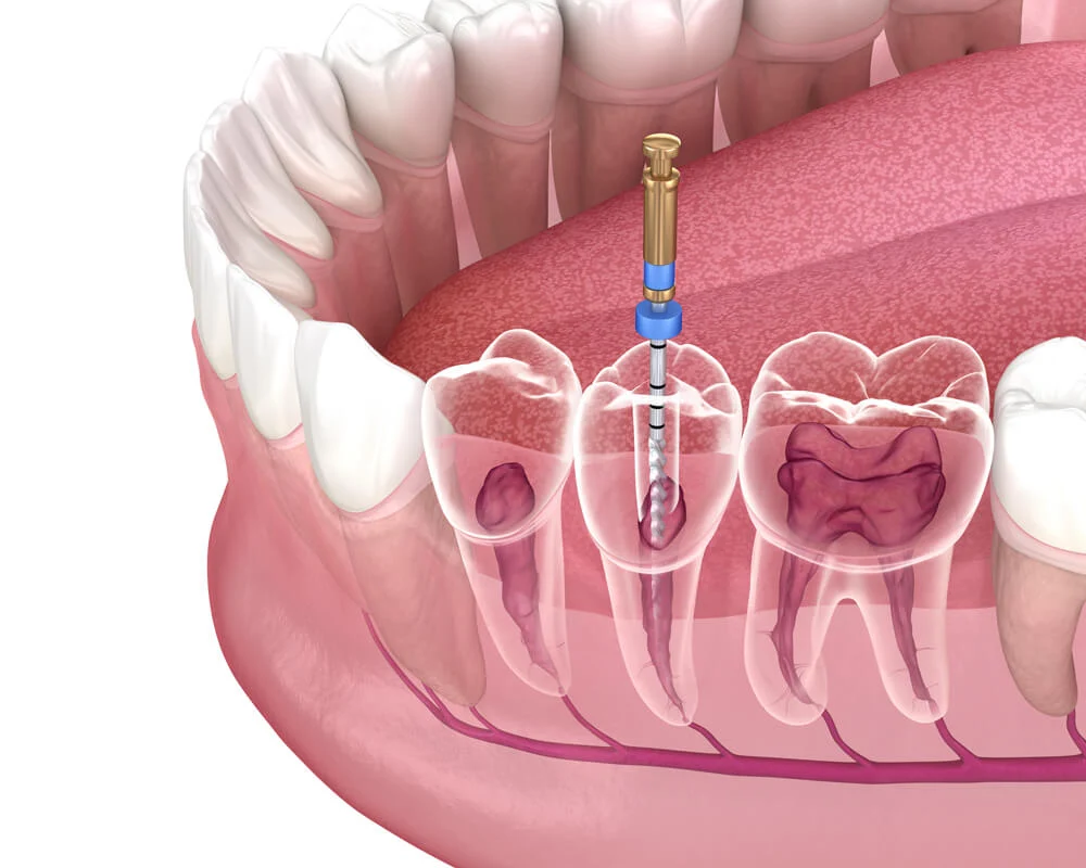 Oso Marguerite Dental Mission Viejo - Dentist - Cosmetic Dentist In Mission Viejo Picture 3
