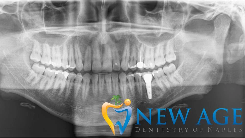 New Age Dentistry of Naples Picture 1