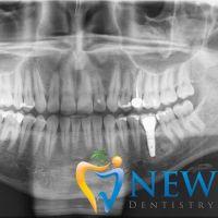 New Age Dentistry of Naples ico