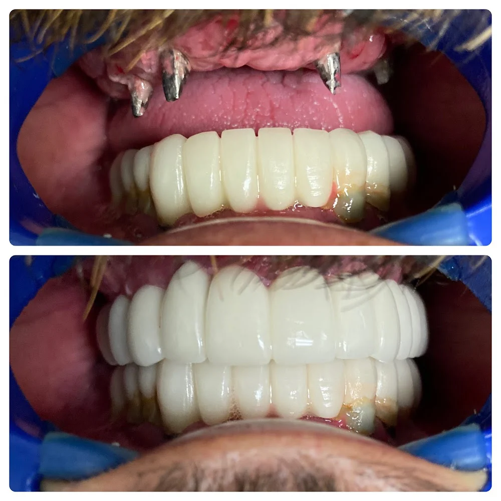 City Dental Centers - Dentist in CoronaCA Picture 8