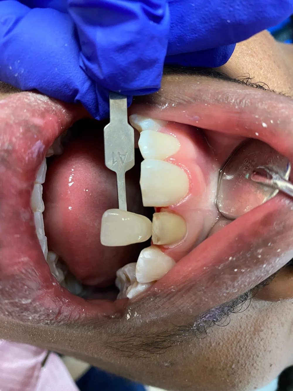 Naples Dental Care Picture 7