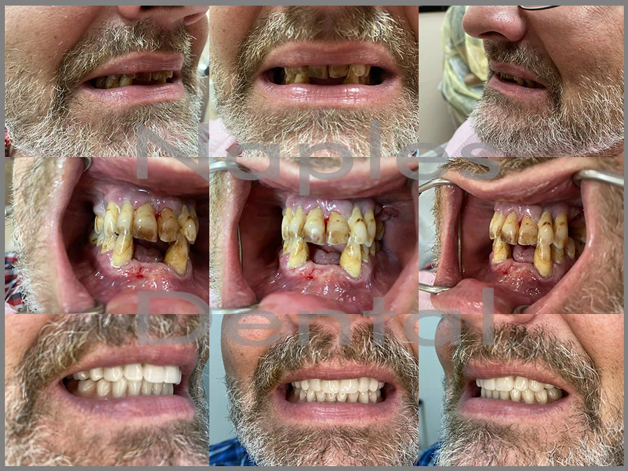 Naples Dental Care Picture 3