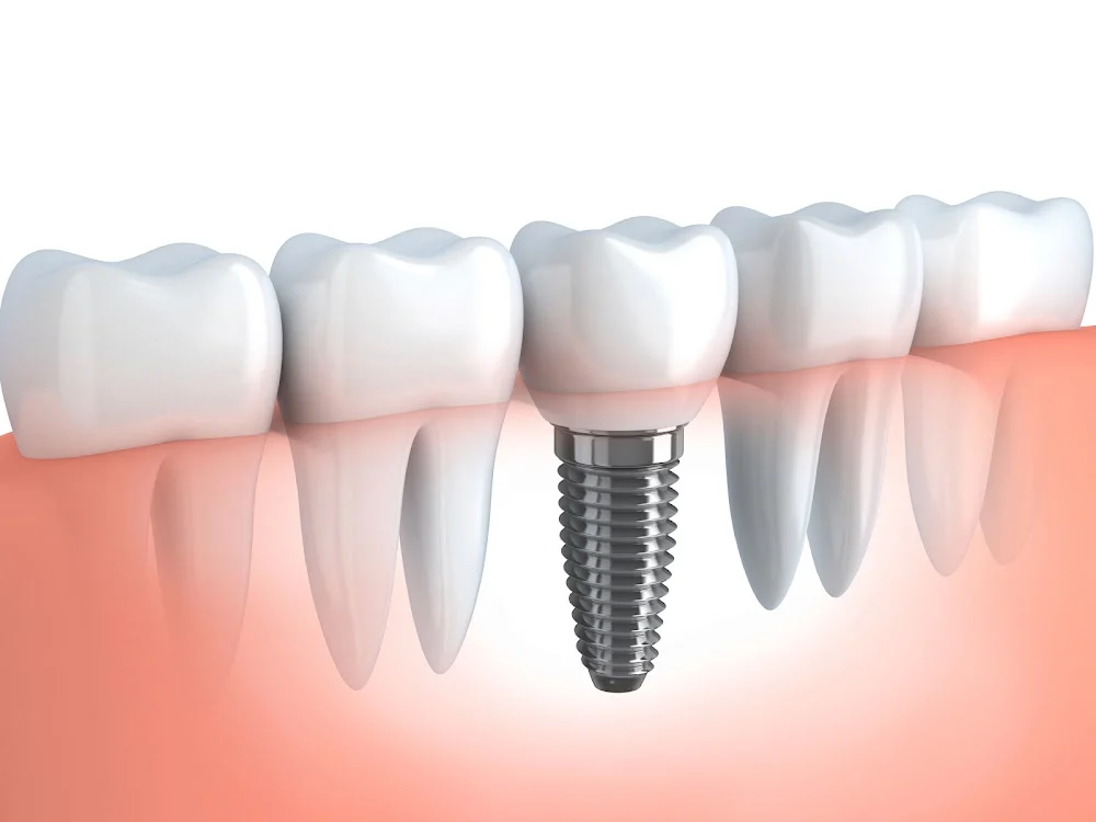 Norco Hills Advanced Dentistry Picture 1