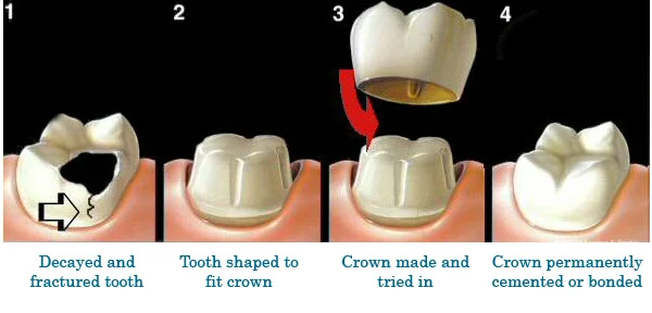 Dental World Picture 5