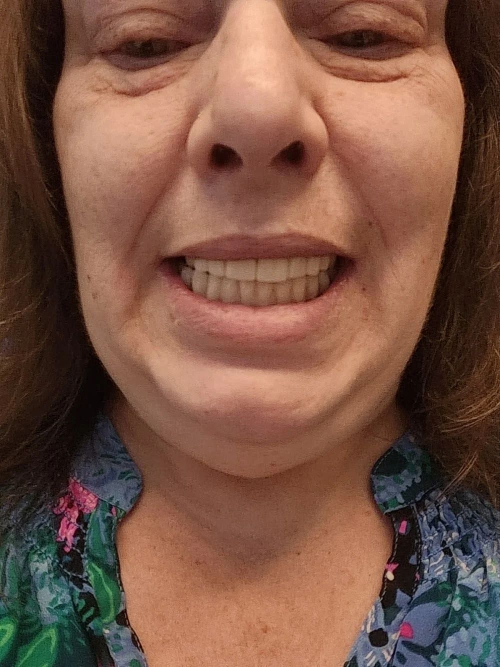 Olde Naples Periodontics - Denise C. Gay, D.D.S, M.D.S Picture 6