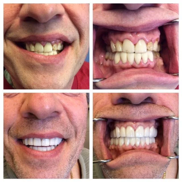 All Smiles Dentistry by: Dr. Sheyda Zahiri Picture 10