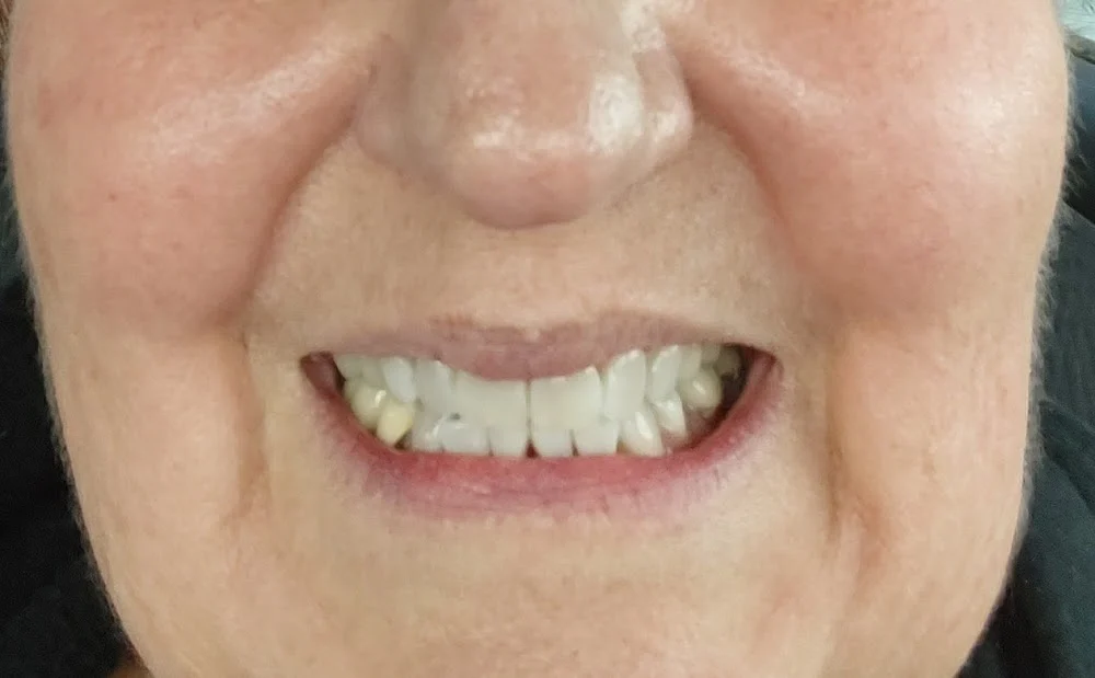 Everett Premier Dentistry: Sumit Makker D.D.S & Andrew Busev D.D.S. Picture 7