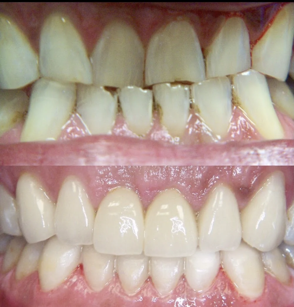 Everett Premier Dentistry: Sumit Makker D.D.S & Andrew Busev D.D.S. Picture 5