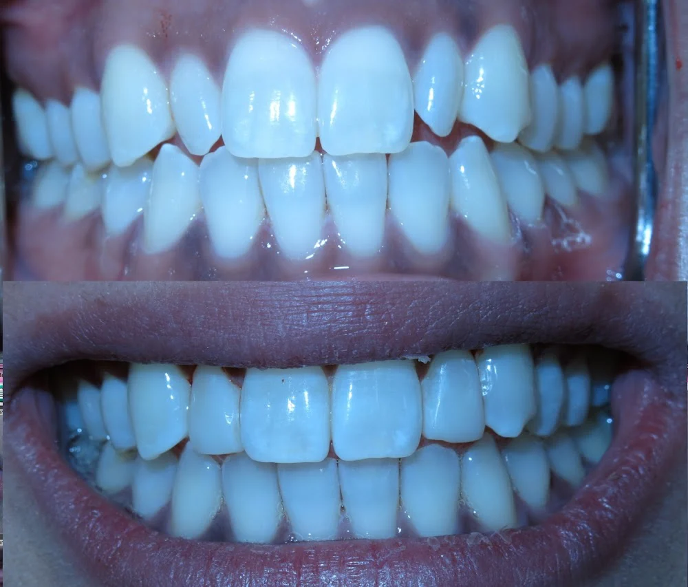 Anthony Vuong DDS Picture 5