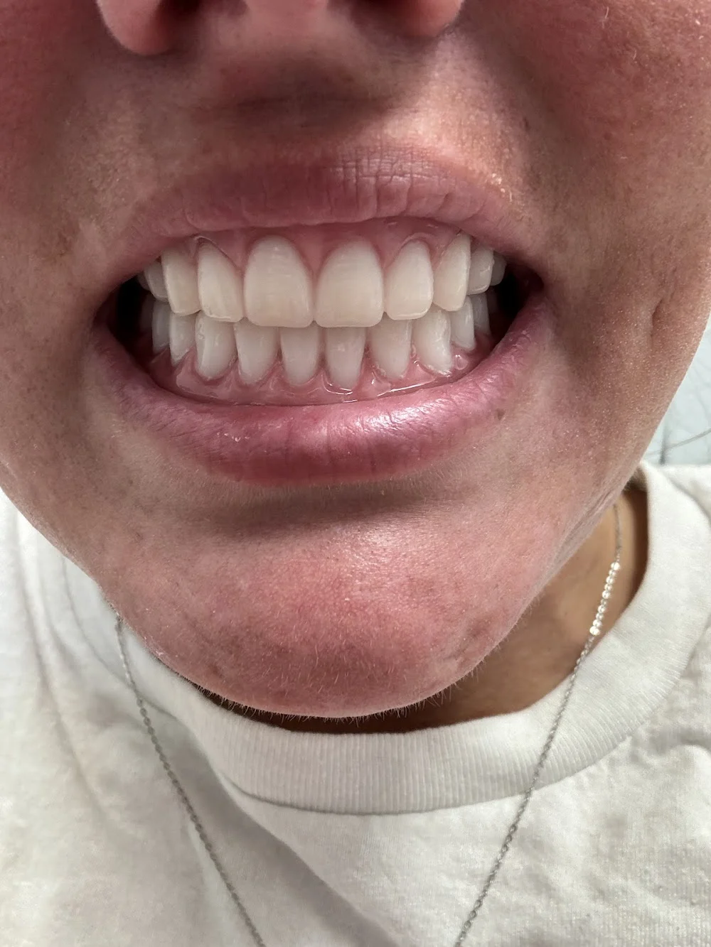 Affordable Dentures & Implants Picture 2