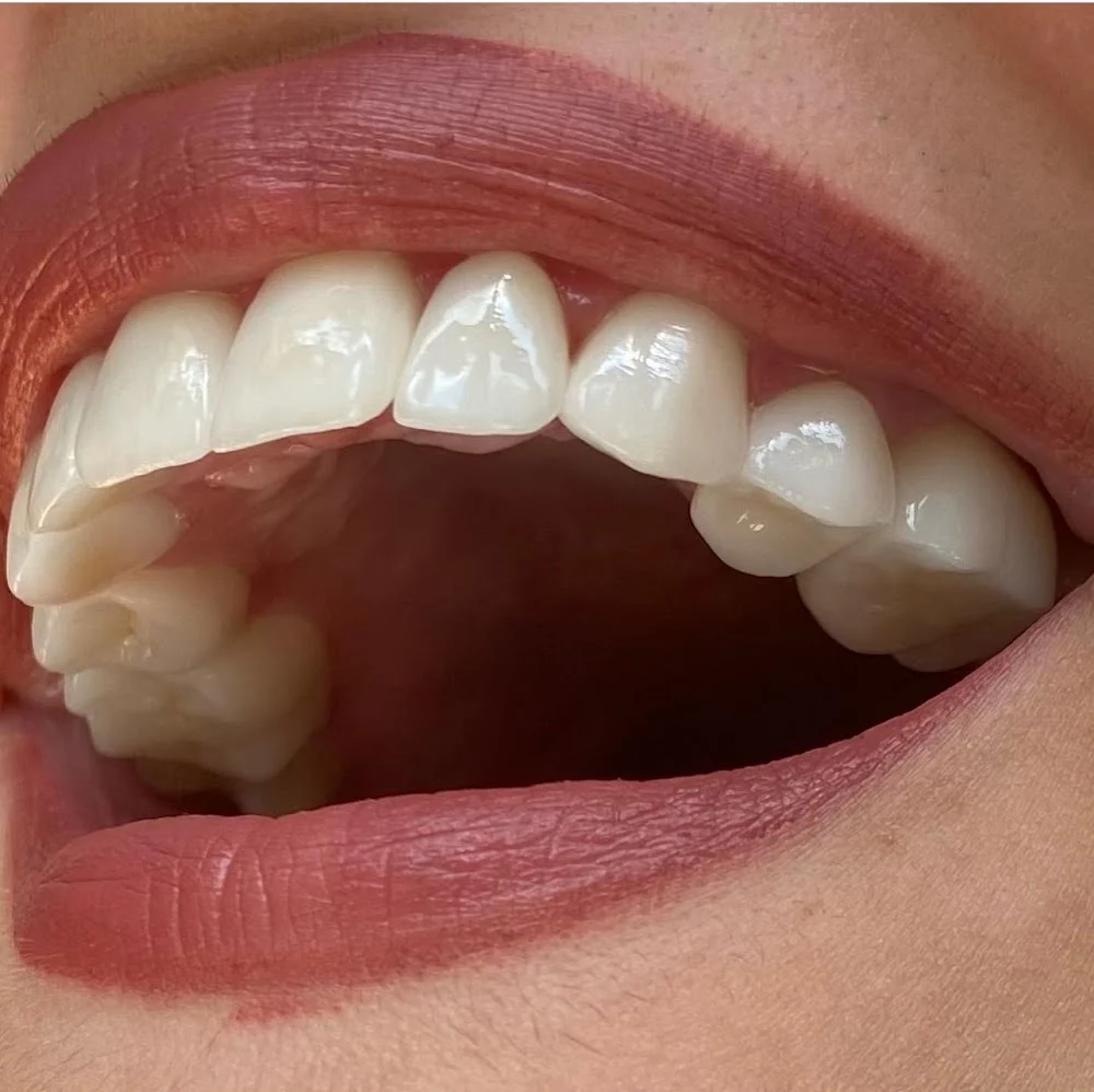 Silkmann DDS Picture 7