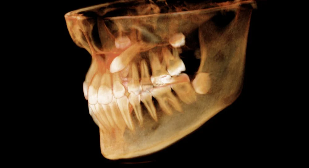 North Atlanta Family Dentistry Picture 7