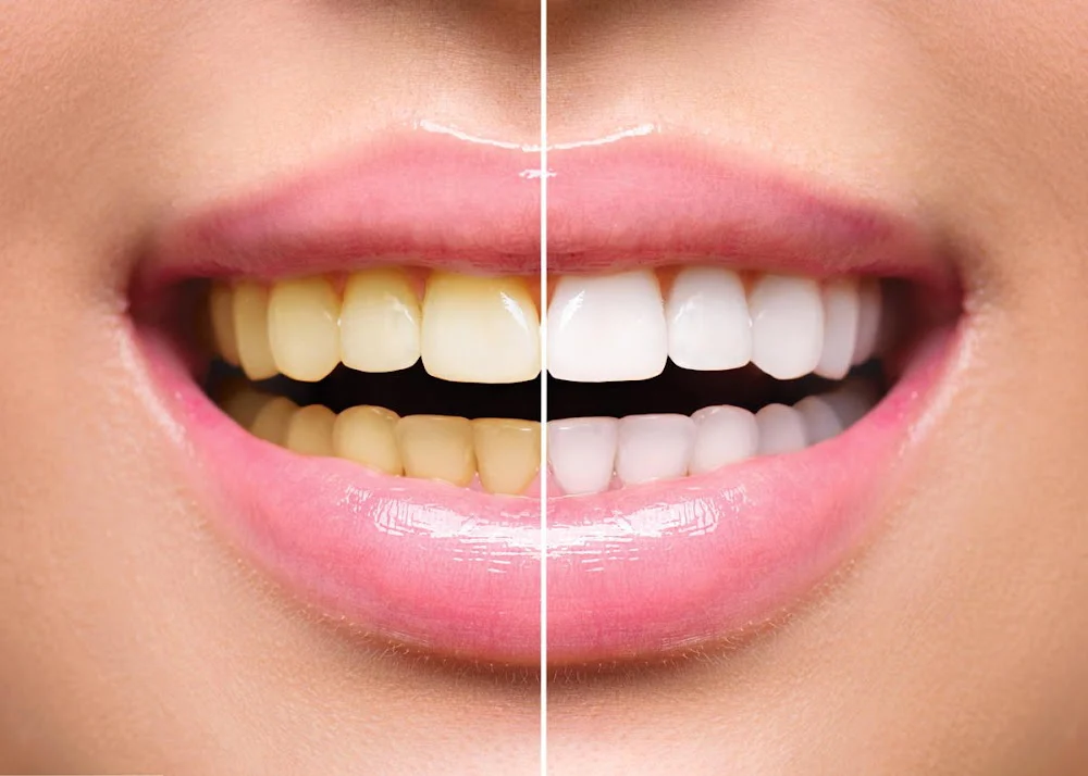 Inspirational Smiles: Imelda Crews, DDS Picture 10