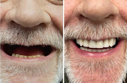 Georgia Implants and Dentures Picture 8