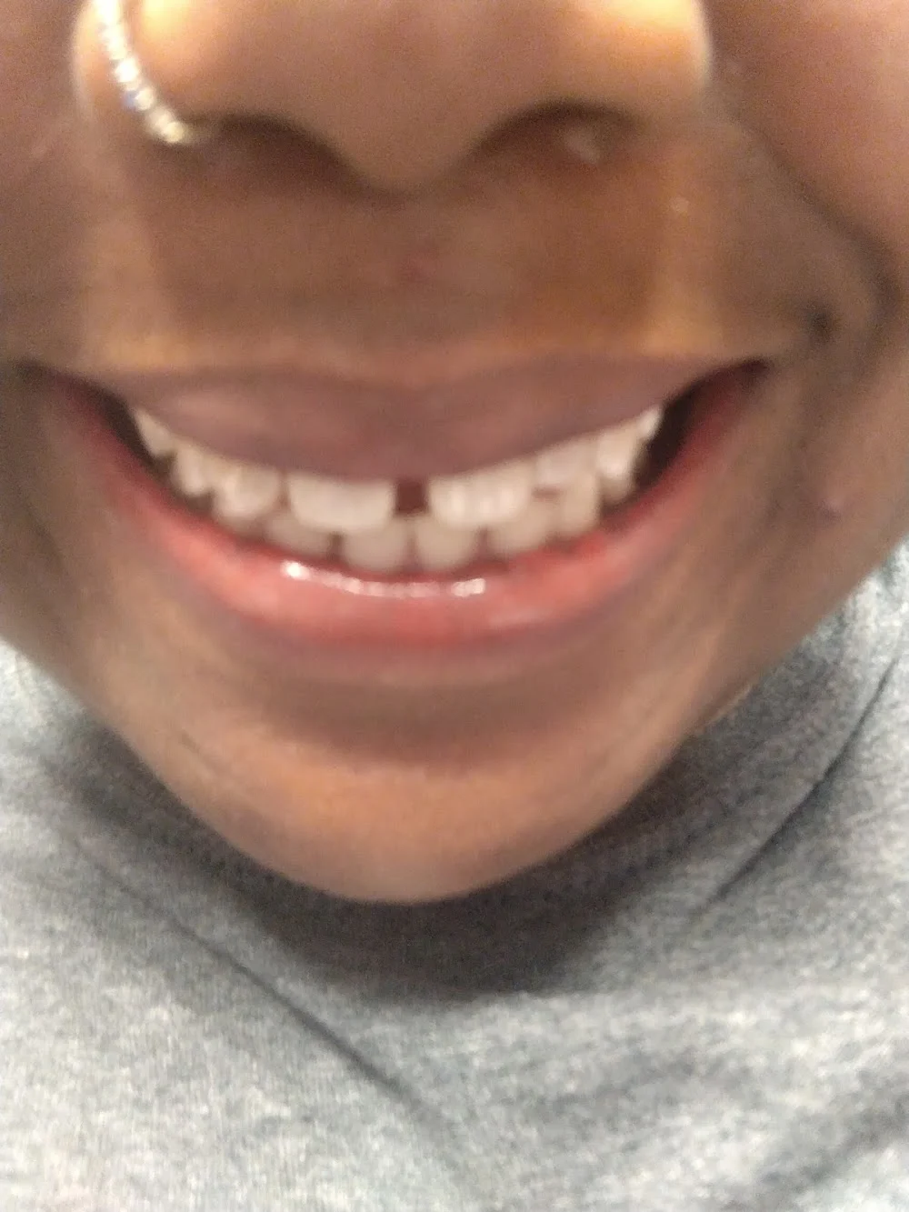 Dental Smiles At Dacula Picture 8