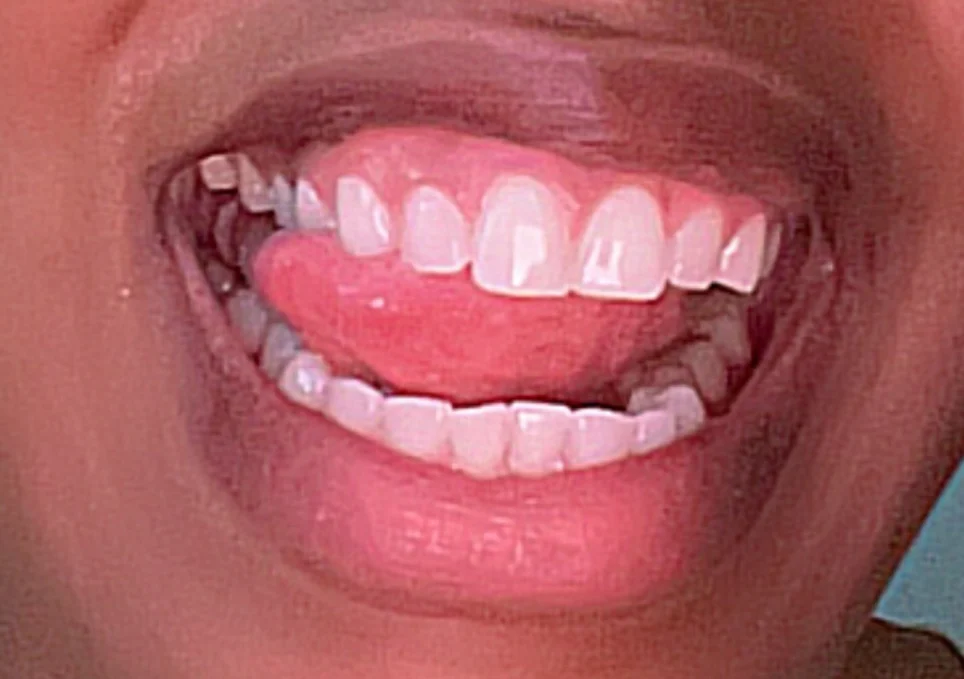 Nova Family Dentistry of Tyrone Picture 5