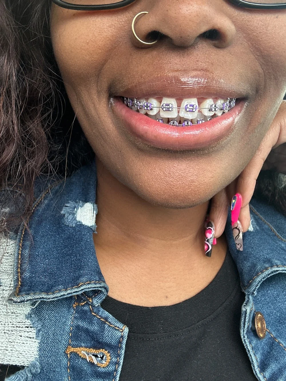 Essence Orthodontics Picture 1