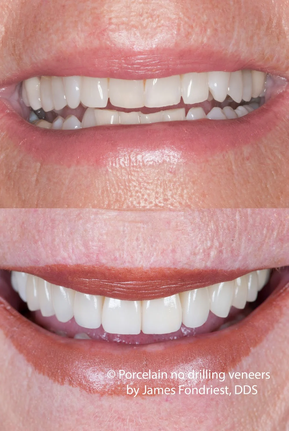 James Fondriest, DDS, FACD, FICD Picture 7