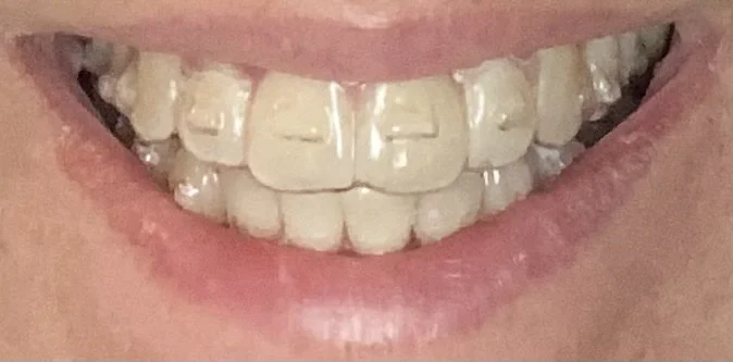 RVA Dental Care Picture 4