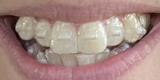 RVA Dental Care Picture 6
