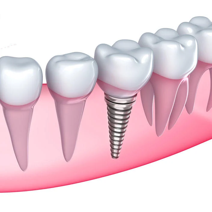 Tall Grass Dental Associates Picture 4