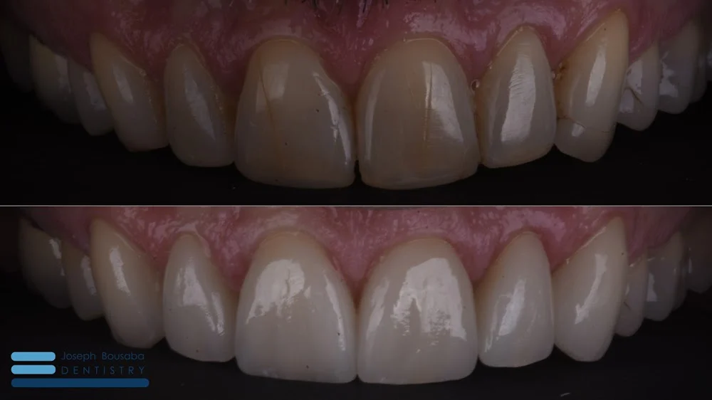 Joseph Bousaba Dentistry Picture 7