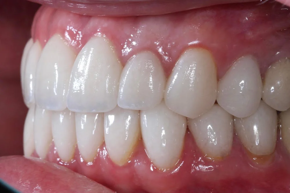 Pinnacle Dental Group - Plainfield, IL (Implant, Cosmetic, and General Dentistry) Picture 4