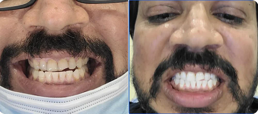 Dental Salon Schaumburg Picture 10