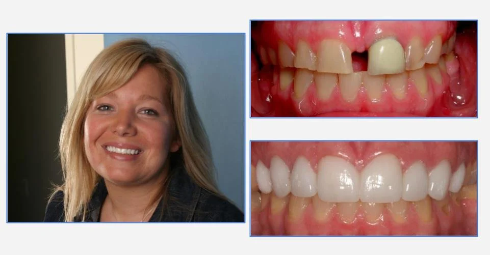 Dental Salon Schaumburg Picture 7