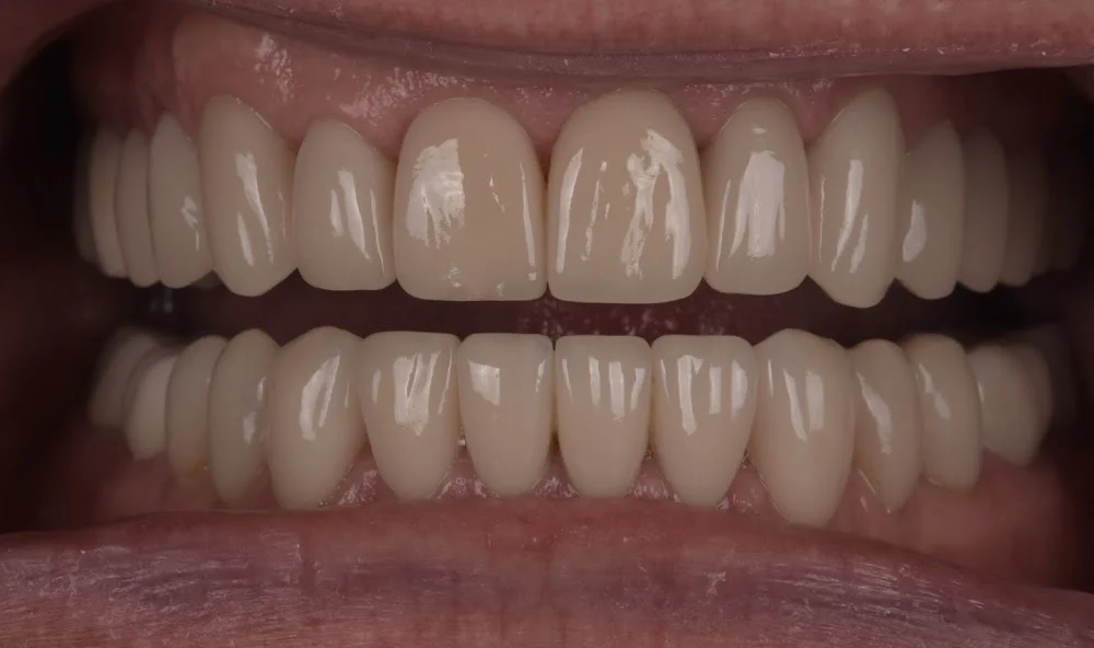 Above & Beyond Dentistry & Implants Picture 10