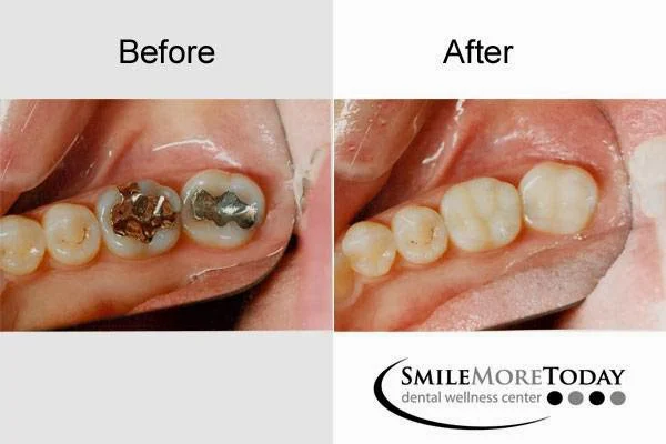 Smile More Today Picture 7