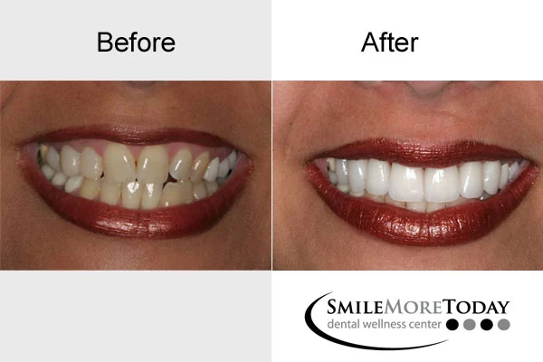 Smile More Today Picture 1