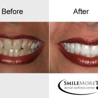 Smile More Today ico