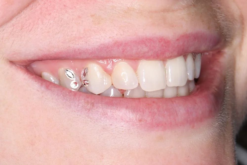 Lovejoy Dental Picture 3