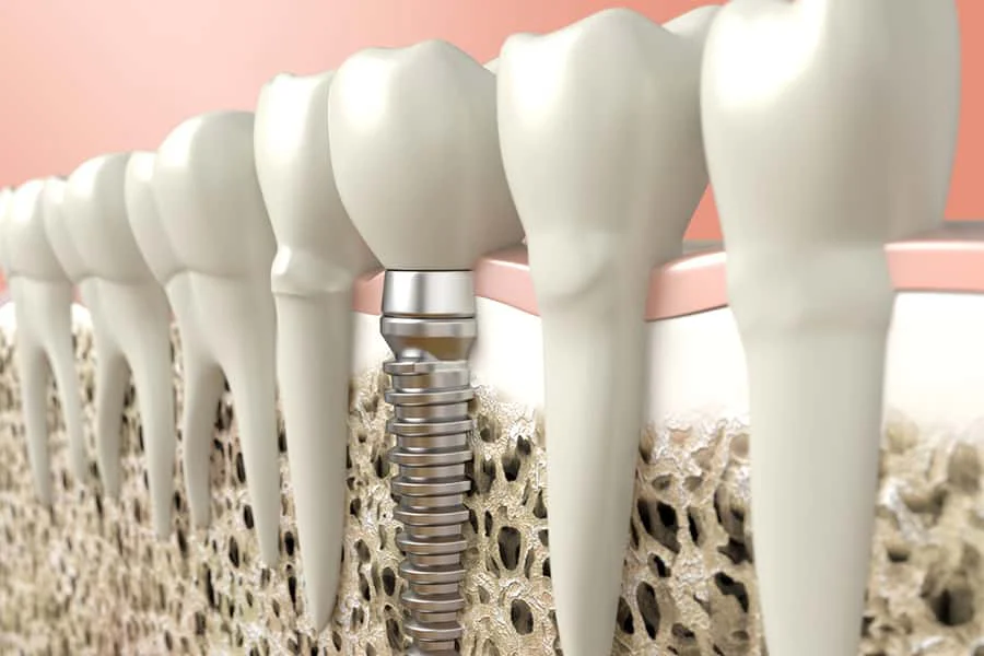Innovative Periodontics & Implants: Donald G Flynn, DDS Picture 3